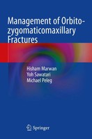 Management Of Orbito-Zygomaticomaxillary Fractures Hisham Marwan (U. A.) Buch