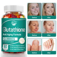 Glutathione Gummies Strong Antioxidant Anti-Aging Skin Whitening Liver Health