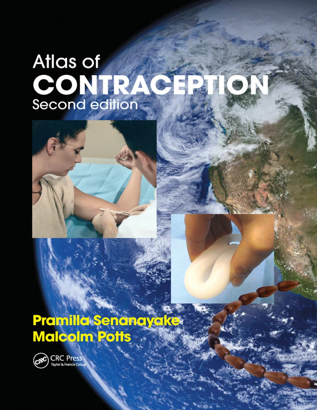 Atlas of Contraception - 2nd Edition