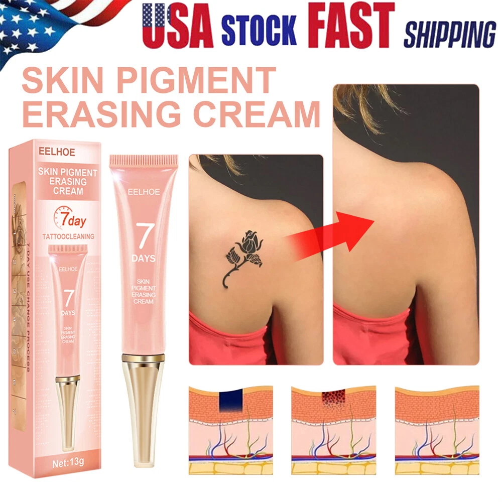 Discover more than 148 tattoo removal cream hindi camera.edu.vn