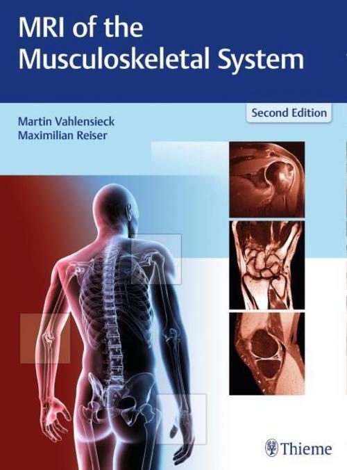 Thumbnail - Mri Of The Musculoskeletal System Martin Vahlensieck