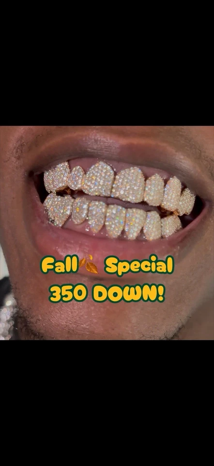 VVS DIAMOND MOISSANITE GRILLZ (PREVENTA) Foto 3 de 4