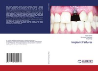 Implant Failures Chetan Ghiyal (U. A.) Taschenbuch Englisch 2024