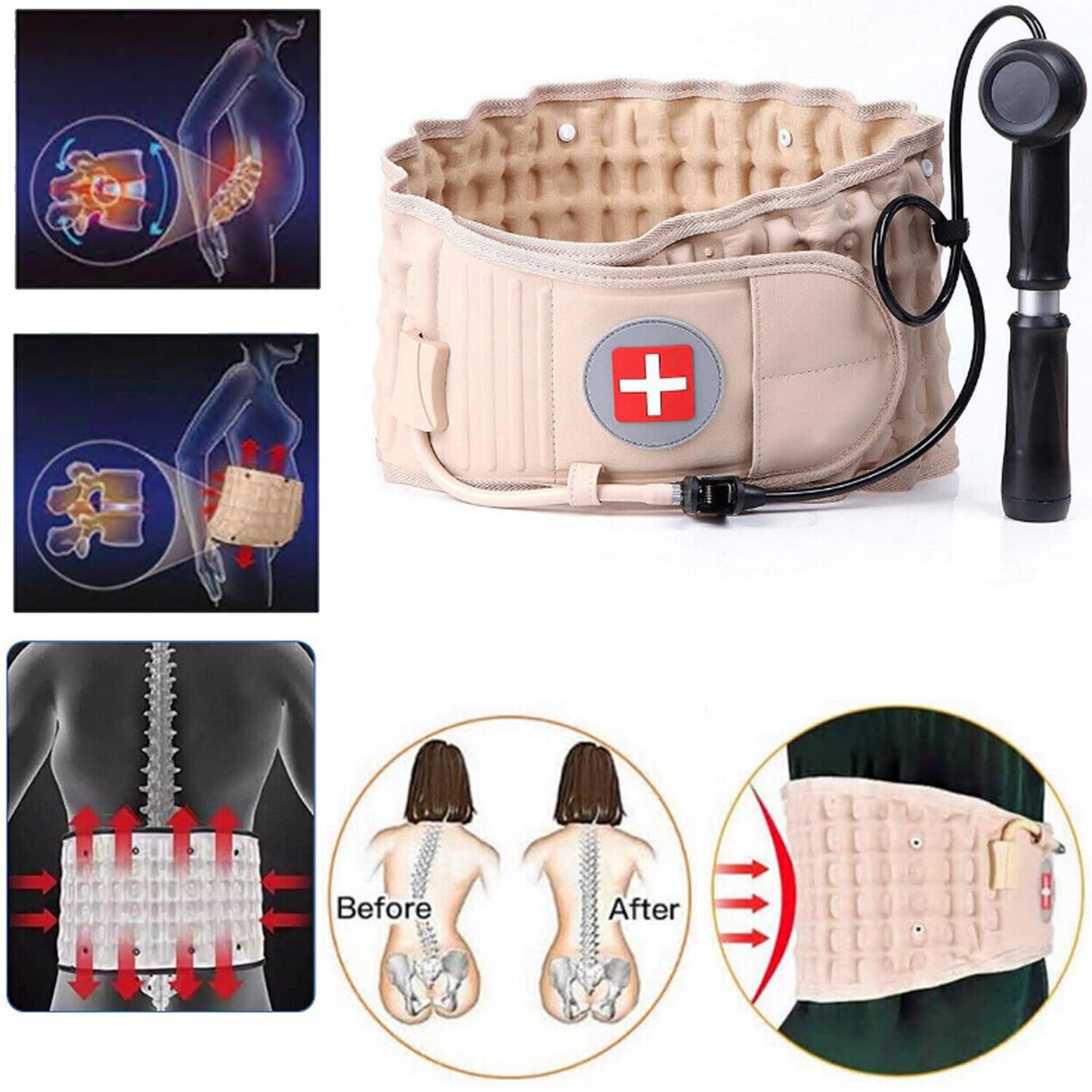 健康・医学 Spinal control Medtronic METRx MIS Neuro Spine Nerve root retractor suction