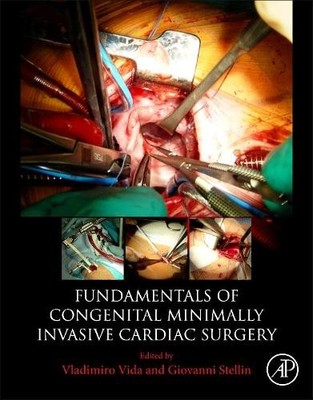 Fundamentals of Congenital Minimally Invasive Cardiac Surgery - 9780128113554