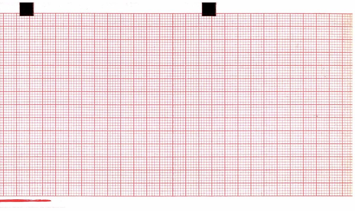 ECG Paper 80MM X 70MM X 300Sheets Works for SCHILLER AT101 ECG Paper 80MM X 70MM X 300Sheets Works for SCHILLER AT101