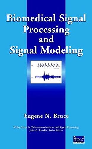 Biomedical Signal Processing and Signal Modeling by Eugene N.... - 9780471345404 - Image 3