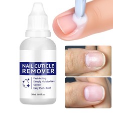 Cuticle Remover Liquid, Instant Cuticle Softener For Dry Damaged Nails -30ml