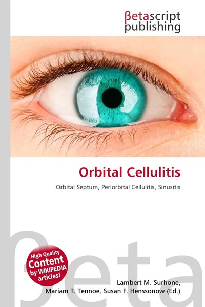 Lambert M. Surhone (U. A.) | Orbital Cellulitis | Taschenbuch | Englisch (2026)-image