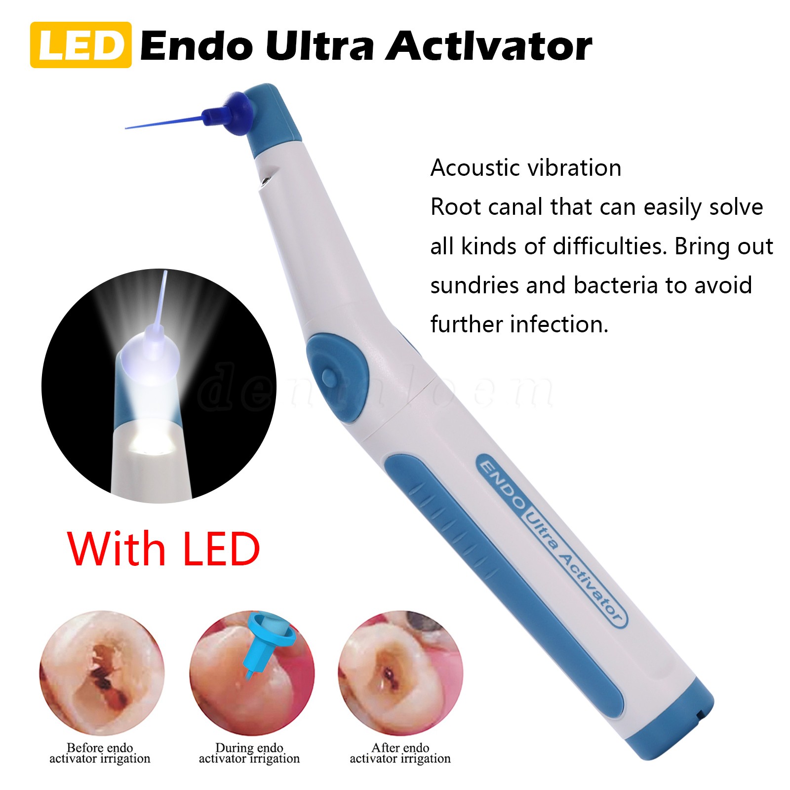 Dental Endo Ultrasonic Activator Root Canal Irrigator Handpiece + Irrigator Tips