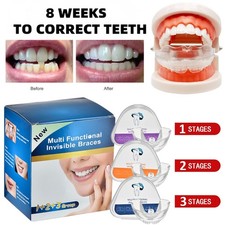 3-Stage Orthodontic Teeth Corrector Braces Dental Tooth Retainer Straighten Tool