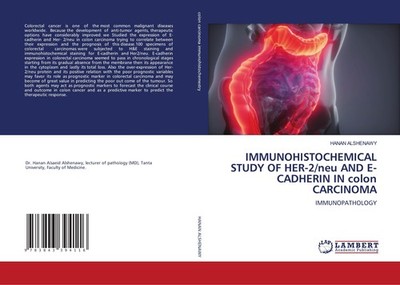 IMMUNOHISTOCHEMICAL STUDY OF HER-2/neu AND E-CADHERIN IN colon CARCINOMA Hanan A