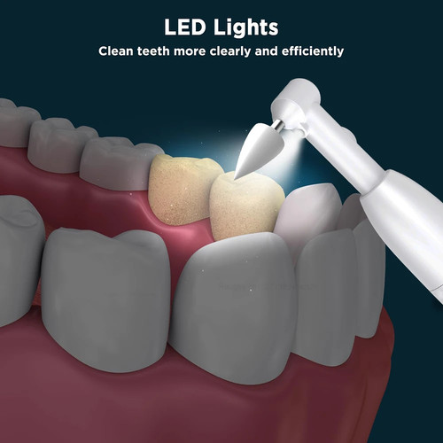 Limpiador dental ultrasónico para el hogar: removedor de placa de sarro, pulidora blanqueadora de dientes// - Imagen 11 de 18
