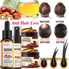 Kirkland Signature Hair Regrowth Treatment Extra Strength For Men 5 Minoxidil Topical Solution 2