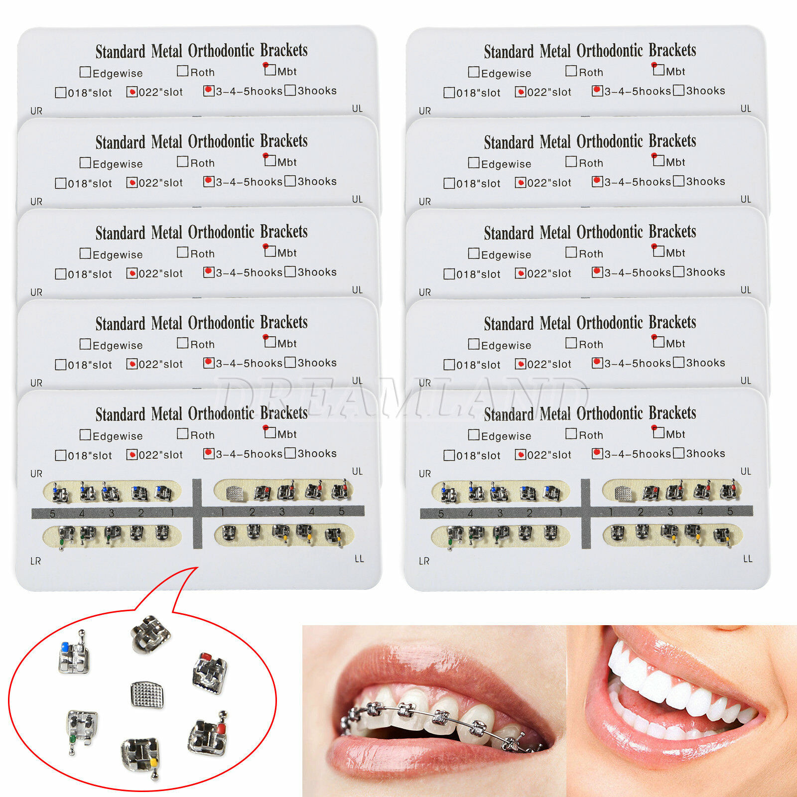 Dentist Orthodontic Brackets Braces Standard MBT 0.022 Slot 345hooks OEM