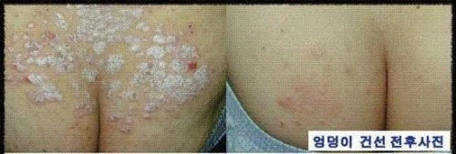 3 Lot of ISAL Atopy Eczema Cream Lotion./Made in USA - Image 4 of 4