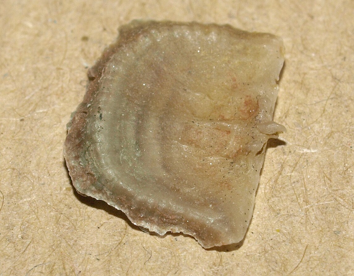 Picture 9 of 11