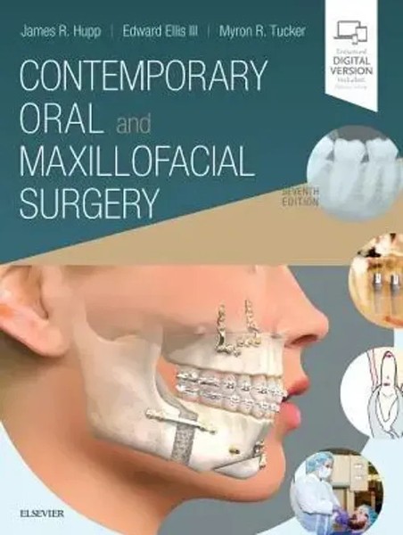 Contemporary Oral And Maxillofacial Surgery | Edward Ellis (U. A.) | Englisch-image