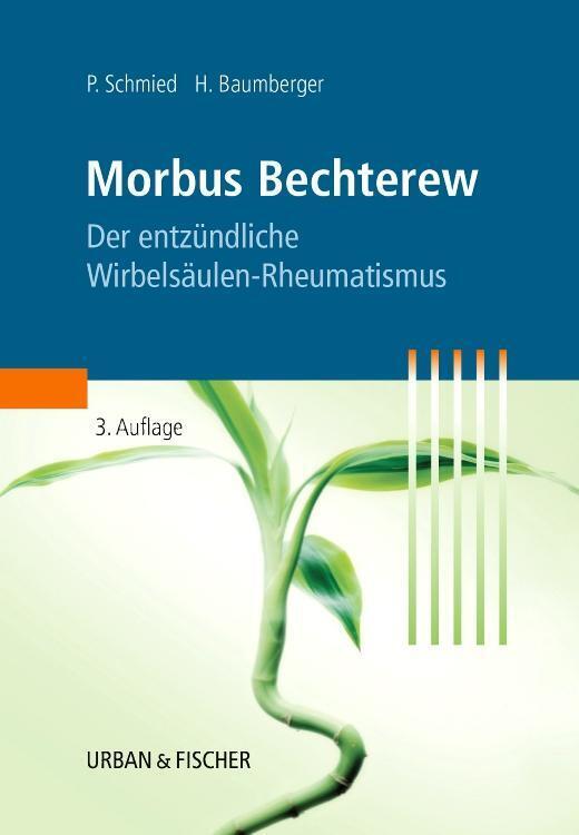 Thumbnail - Morbus Bechterew | Der Entzündliche Wirbelsäulen-rheumatismus |