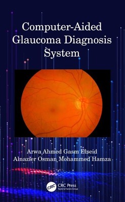 Computergestütztes Glaukom-Diagnosesystem, Hardcover von Elseid, Arwa Ahmed Gas...