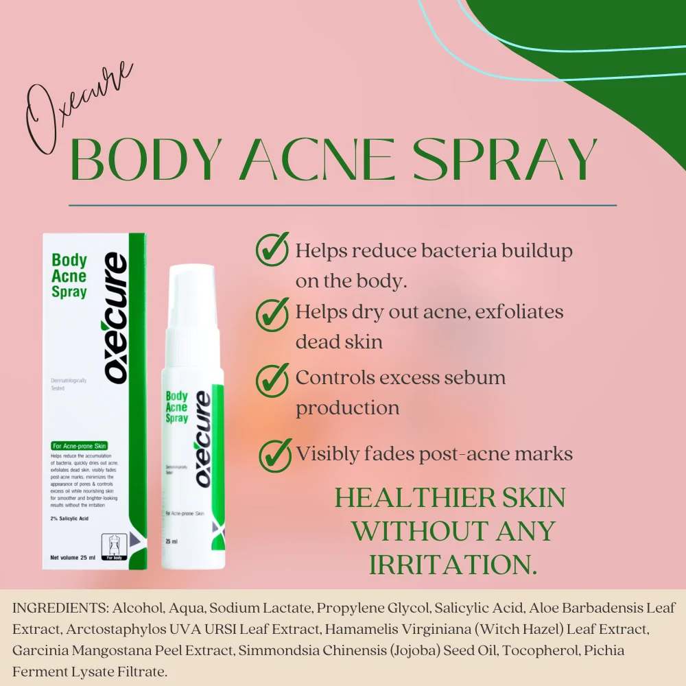 Body Acne Spray 25ml Health and Beauty Personal Care Product eBay