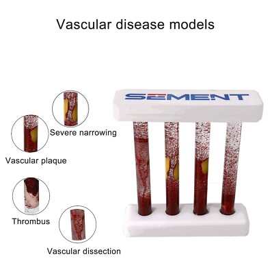 1PC Vascular Pathology Model, With Blood Flow Simulation, Medical Surgical Train