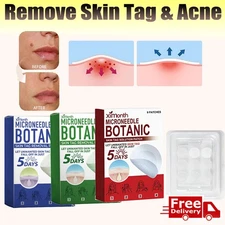 MICRONEEDLE BOTANIC Skin Tag & Acne Patch Skin Tag Remover Patches 9Pcs HOT 2025