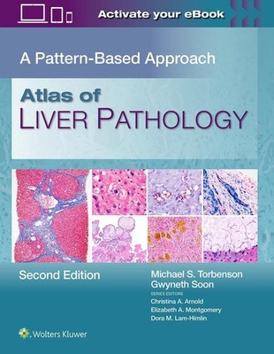 Atlas of Liver Pathology: A Pattern-Based Approach by MICHAEL SCOTT TORBENSON Ha