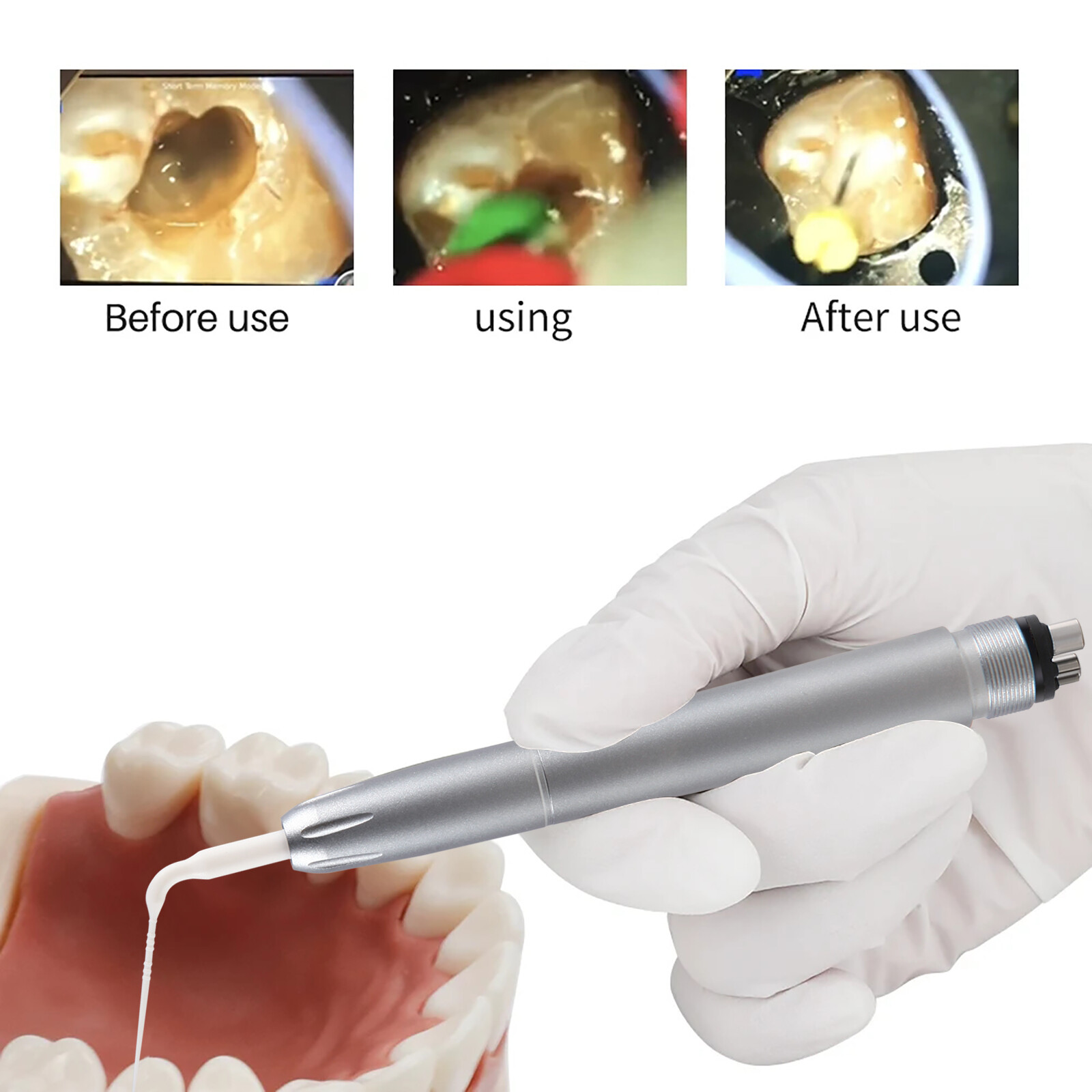 Dental air scaler handpiece Sonic w/ 5 Endo IrrigatIon Tip fit NSK KAVO