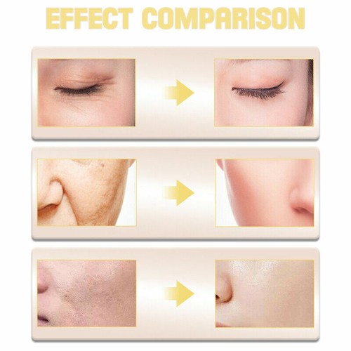 Nourishmax Vitamin C, B, E and Ferulic Acid Serum, Vitamin C+B+E+