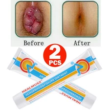 2Pcs Hemorrhoids Remove Ointment Herbal Cream Relief Piles Pain Reduce Itching