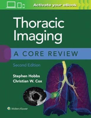 Thoracic Imaging: A Core Review - Paperback By Hobbs MD, Stephen - GOOD
