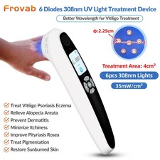 308nm Excimer Laser Light Home Compact Skin Disorder Therapy for Skin Conditions