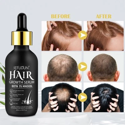 WHITE MANDARIN 5% Minoxidil+Biotin 60ml for Hair Growth Serum Hair loss regrowth for Men Women