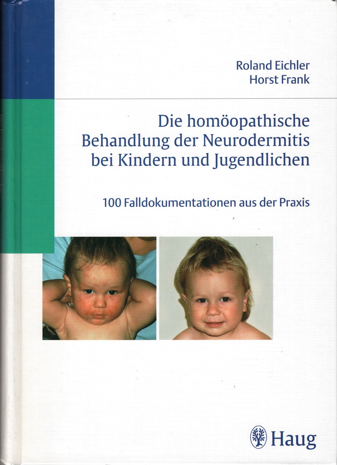 Die homöopathische Behandlung der Neurodermitis bei Kindern und Jugendlichen
