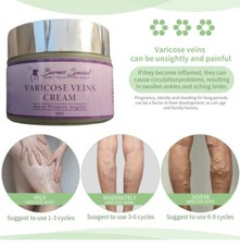 Varicose Veins Relief Cream Relieve Tired Legs Spider Pain Tighten Smooth Skin