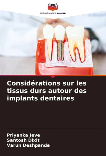 ConsidéRations Sur Les Tissus Durs Autour Des Implants Dentaires Jeve (U. A.)-image