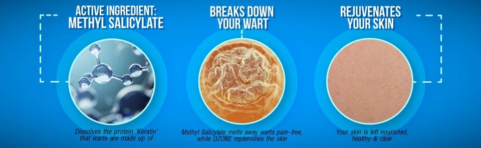 SOMXL Crema Trattamento Rimozione Verruche Genitali - Spedizione Gratuita e Discreta Inclusa. - Immagine 3 di 3