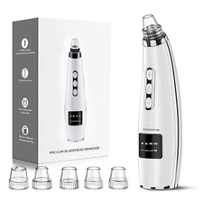 LED Blackhead Remover – Pore Vacuum Cleaner with Light Therapy & Suction