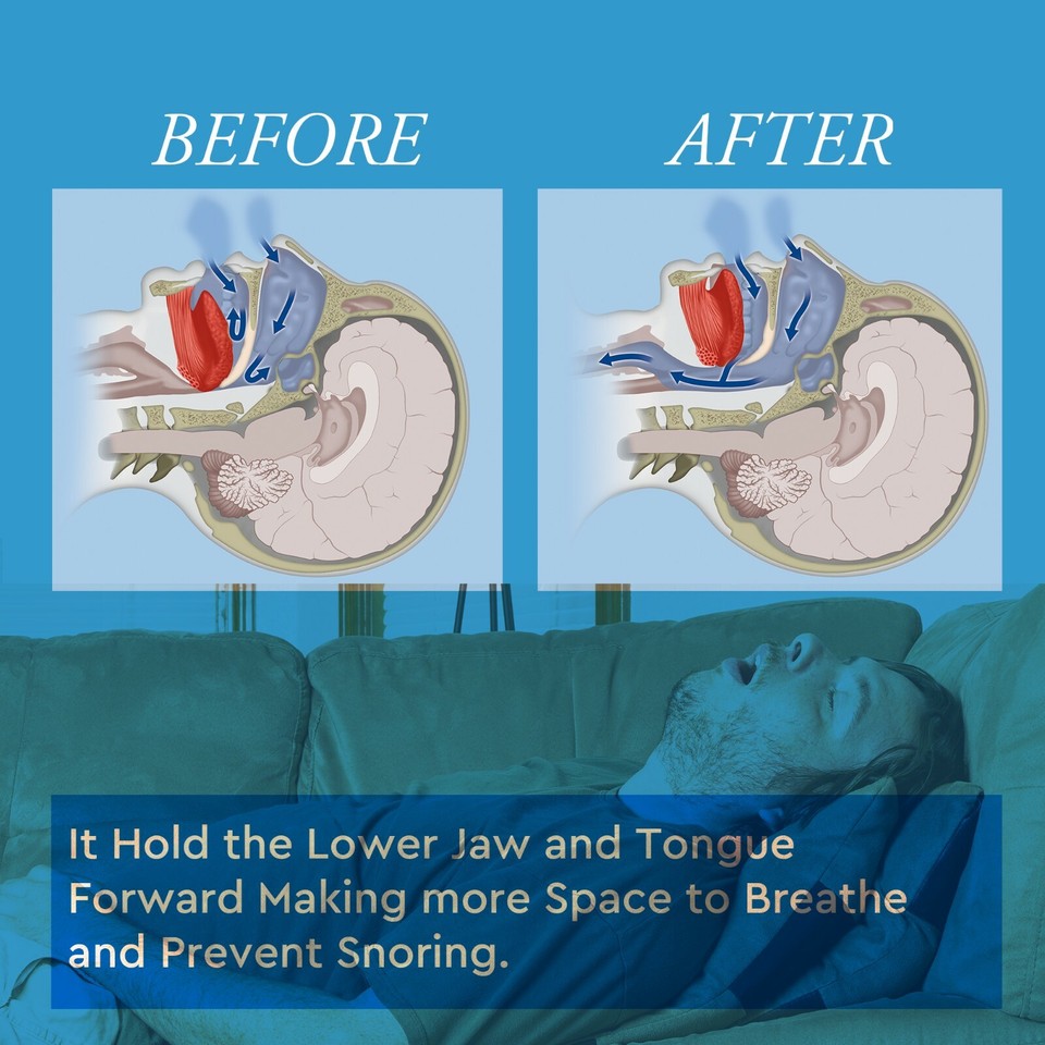 Stop Snoring Mouthpiece Sleep Apnea Guard Bruxism Anti Snore Pure Grind