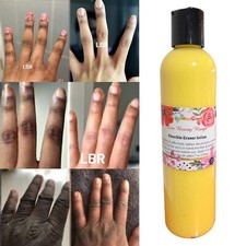 FAST ACTION KNUCKLE ERASER CREAM DARK FEET,KNEES  ELBOW 3X ACTION RESULTS 6oz  