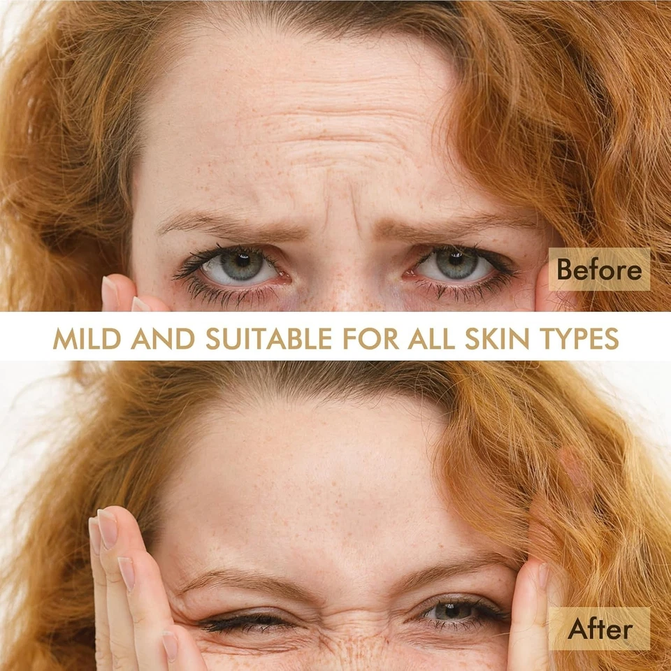 24 Cerotti Antirughe Patch Facciali per Fronte Viso acido ialuronico collagene - Immagine 2 di 4