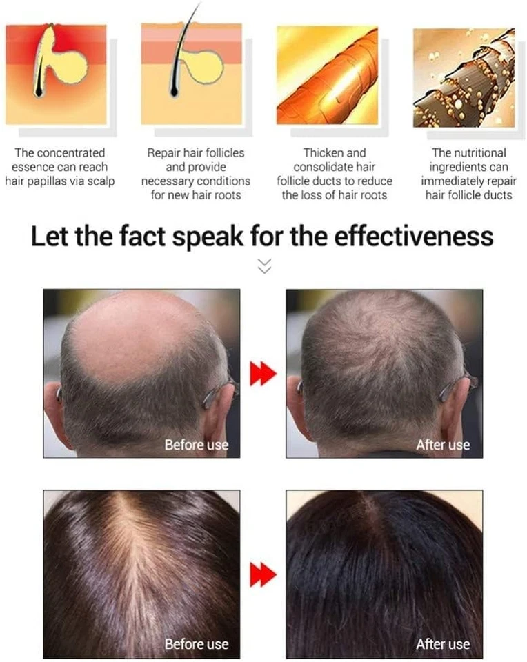 Tónico mágico para el crecimiento del cabello con ginseng - Tratamiento de pérdida de cabello 60 ml para hombres y mujeres, Foto 4 de 4