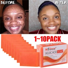 1-10PACK Kojic Acid Brightening Soap Skin Whitening Dark Spots lightening Acne