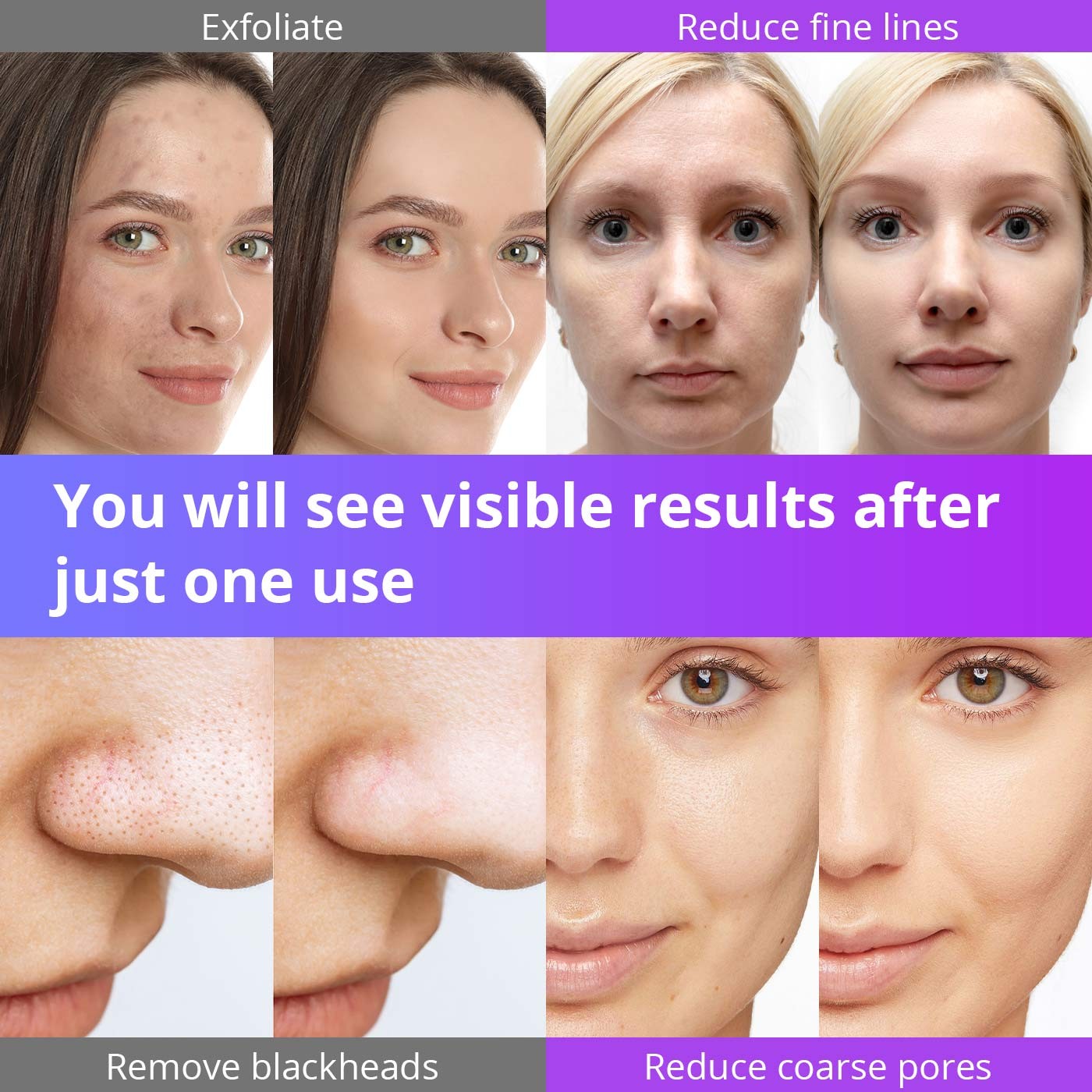 4 in 1 Facial Peeling Microdermabrasion Machine Salon Home Skin Care Device