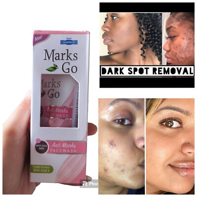 HAPDCO Marks Go Facewash Reduces Marks & Dark Spots 65gm Keeps skin Clear