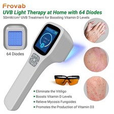 308nm UVB Phototherapy Light Device Home Use Handheld LCD 5 Filters Rechargeable