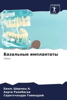 Ewans Shirley A. (U. A.) | Bazal'nye Implantaty | Taschenbuch | Russisch (2023)