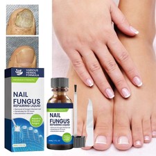 Fungal Nail Treatment, Extra Strong Repair Nail Serum for Toenail Fing 30ml