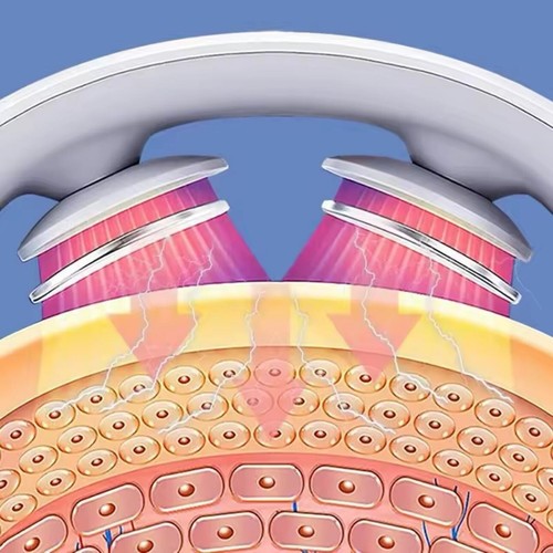 Nackenmassagegerät - Nacken- und Schultermassagegerät (therapeutisch) - Bild 5 von 6